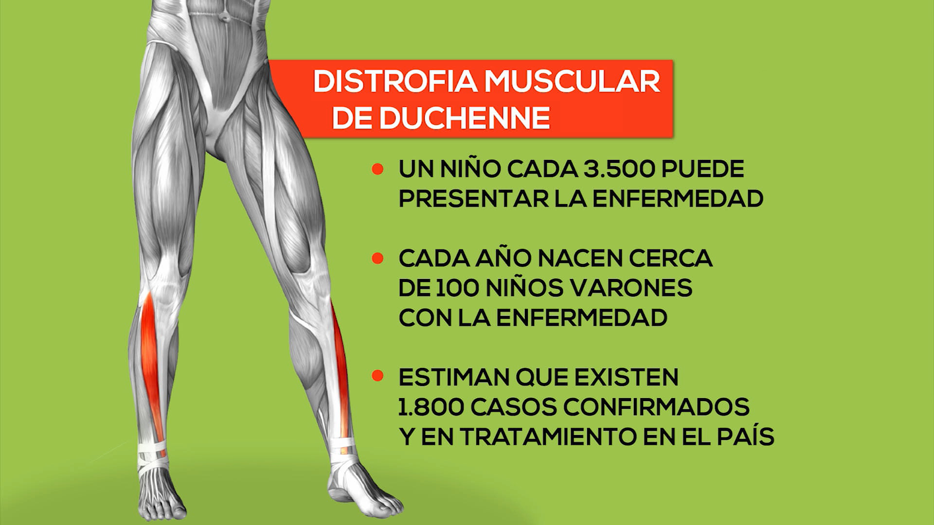 Enfermedad de Duchenne cómo es vivir toda la vida con músculos débiles Canal Televida Mendoza